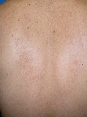 Après