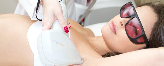 Séance d’épilation laser LightSheer en centre Dermocare